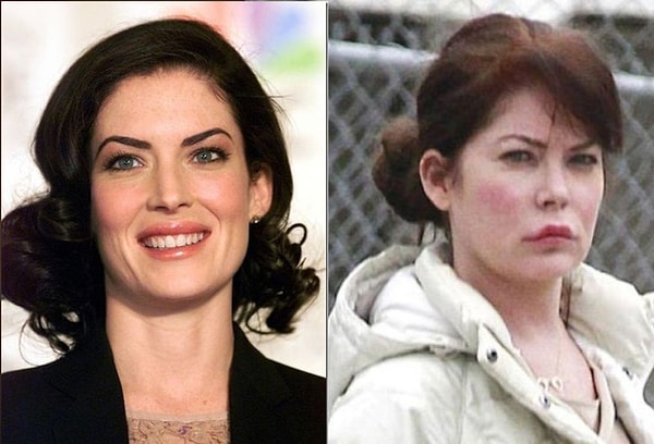 2. Лара Флинн Бойл. Страсть к пластике отняла сексуальность у звезды 90-х.