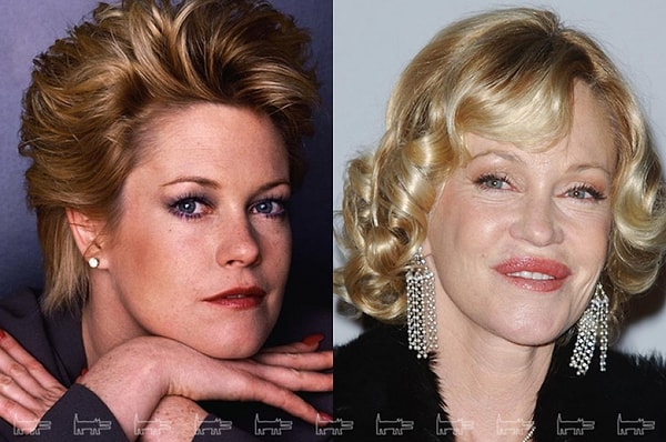 5. Мелани Гриффит. Неудачные "улучшения" во внешности привели к краху брака.