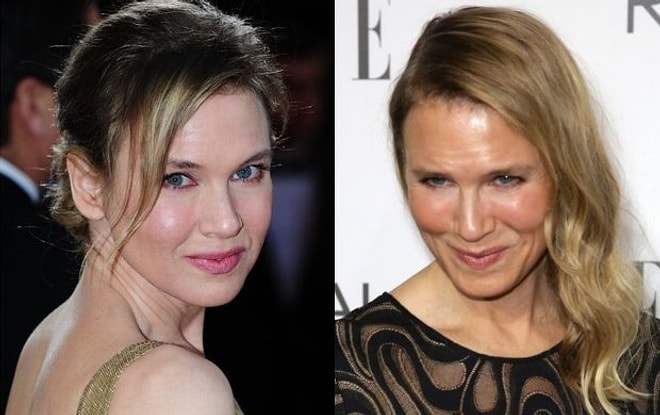 Нет пути назад: 9 звездных красавиц, ставших жертвами пластической хирургии