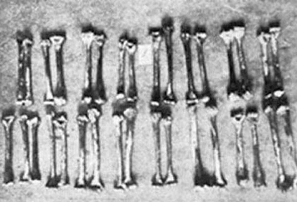 5. Ганноверский маньяк Фриц Хаарманн, убивавший своих жертв укусом в шею