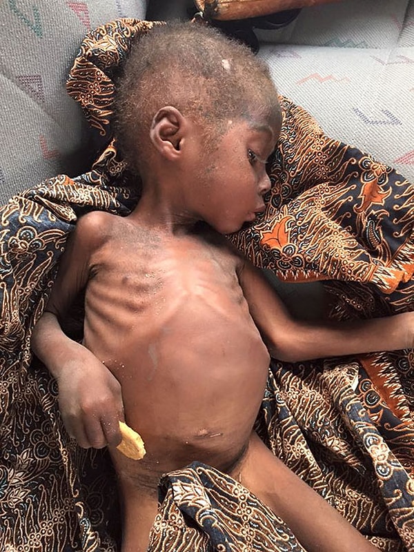 3. Мальчик, которого назвали Хоуп (от англ. hope - надежда), был брошен родителями из-за подозрений в колдовстве!