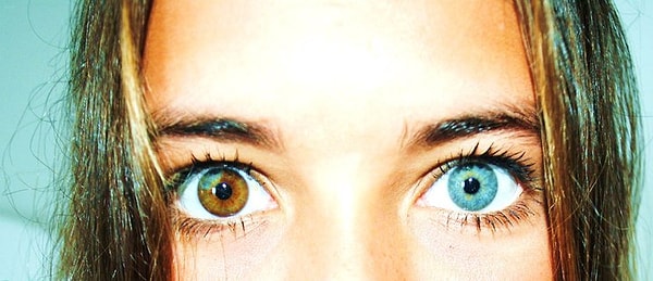 1. Говоря научным языком, гетерохромия — это отличный друг от друга цвет радужных оболочек правого и левого глаза, либо неоднородная окраска радужки одного глаза.