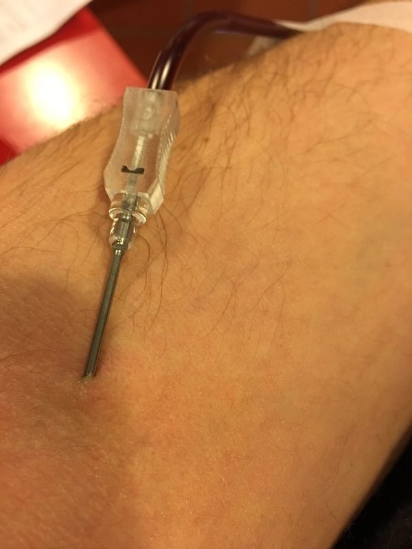 17. А эта игла просто висит, её вонзили в ваше тело... Как неестественно расширены вены!