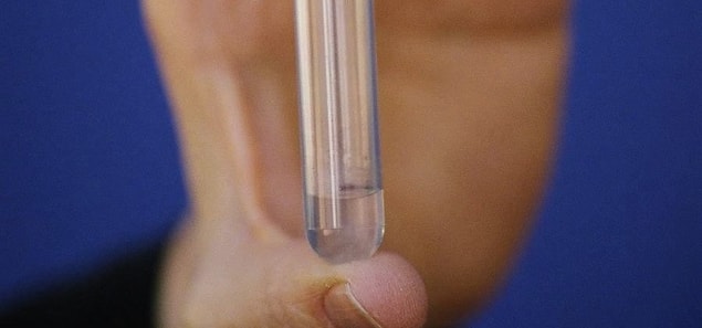 Bu yeni yöntemde ise spermlerin üretraya ilerlemesini önleyecek alternatif bir vasektomi yöntemi olan "Vasalgel" adı verilen bir ürün üzerinde çalışılıyor.