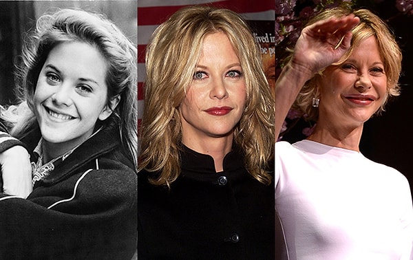 3. Мег Райан. Лицо актрисы стало напоминать подушку.