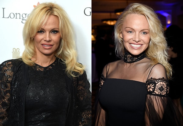 1. Памела Андерсон. Ее внешность за последние несколько лет изменилась до неузнаваемости.