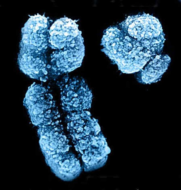 These individuals may also be born with mosaic genetics. In other words, some cells may have XX chromosomes, while some have XY chromosomes.