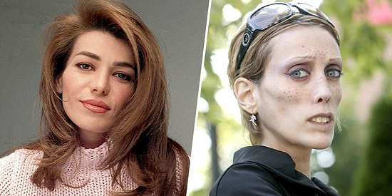 10 звёзд, чьи жизни прервала анорексия