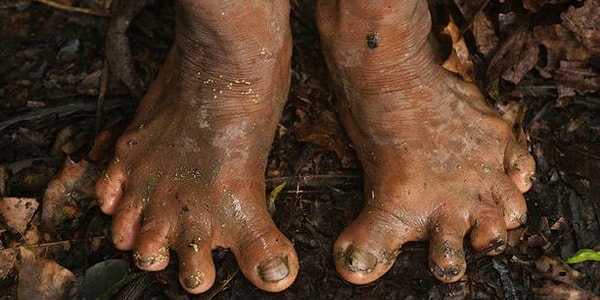 4. Из-за того, что большую часть племени дикари проводят лазая по деревьям, у них развивается плоскостопие. Поэтому их деформированные ступни выглядят просто ужасно: