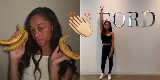 Muza Benzeyen Çilleri Yüzünden Zorbalığa Uğrayıp Süper Model Olan Kız: Salem Mitchell