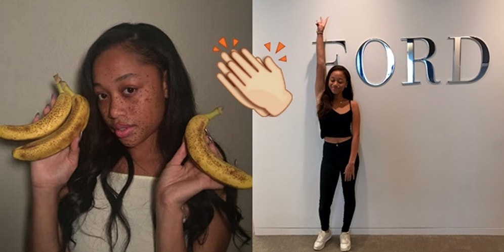 Muza Benzeyen Çilleri Yüzünden Zorbalığa Uğrayıp Süper Model Olan Kız: Salem Mitchell