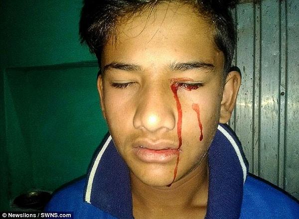 "Stigmata çocuk" olarak adlandırılan Hint genç, 10 yaşından bu yana kan ağlıyor.
