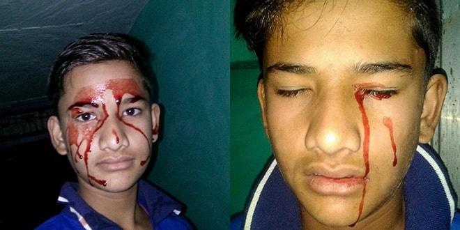 Tıp Bilimi Çaresiz Kaldı! Bazen Günde 10 Defa Kan Ağlayan Hindistanlı Stigmata Çocuk