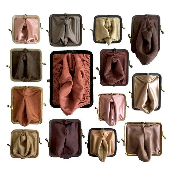 5. Обследовав Чжан, врачи обнаружили у нее синдром Майер-Рокитанского-Кустер-Хаузера — аномалию, которая проявляется в отсутствии матки и/или большей части влагалища.