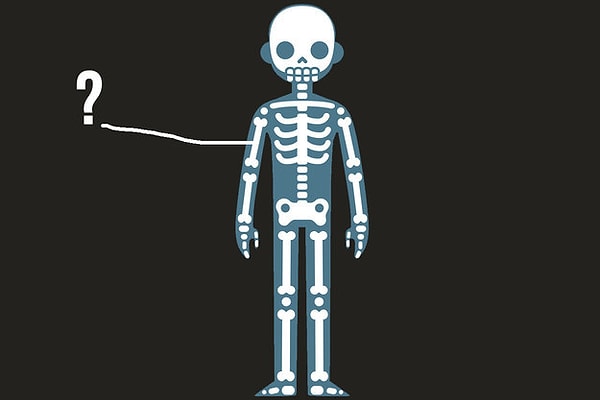 8. Что это за кость?