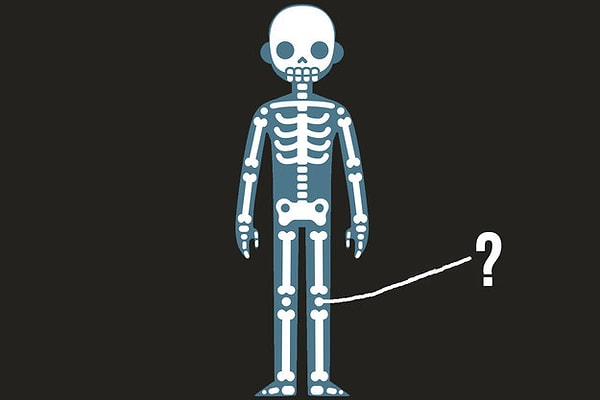 10. Как называется эта кость?