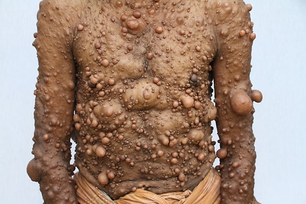 5. Шадот, отец троих детей, говорит, что жить, постоянно мучаясь болями очень тяжело