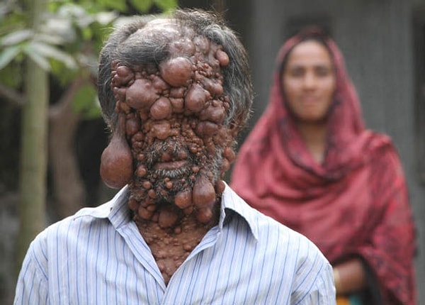 6. «Едва лишь кто-нибудь бросает на меня взгляд, он тут же спешит удалиться. Дети же вообще, завидев меня, кидаются врассыпную»