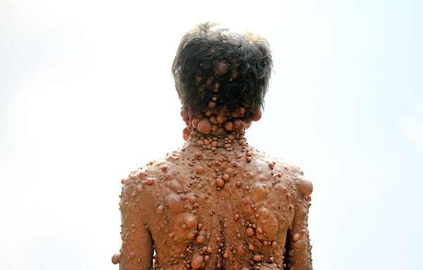 11. Но из-за того, что у семьи нет денег, они могут надеяться только на благотворительность