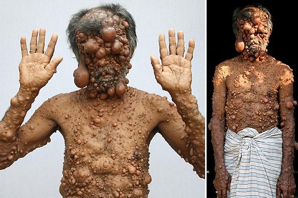 12. Известно, что необходимая для операции сумма уже собрана. Осталось только пожелать Шадоту скорейшего выздоровления