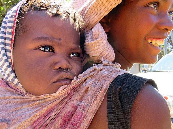 Bonus-2: Şu Madagaskarlı bebeğin gözlerine baksanıza..