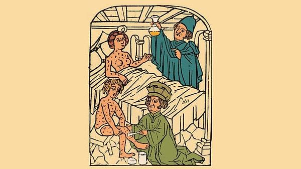 Bu ilk başta size garip gelebilir dostlar. Fakat salyangoz suyu, Ortaçağda cinsel yolla bulaşan hastalıklar için kullanılan bir panzehirdi.