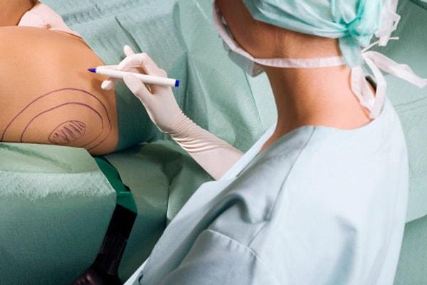 12. Liposuction yani yağ aldırma operasyonları en sık alt karın, sırt ve baldırlarda uygulanır.