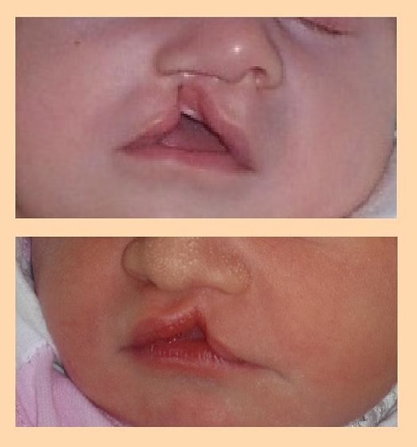 7. Существует два основных вида пластической хирургии: эстетическая (косметическая) и реконструктивная.