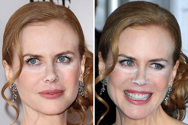 11. Николь Кидман