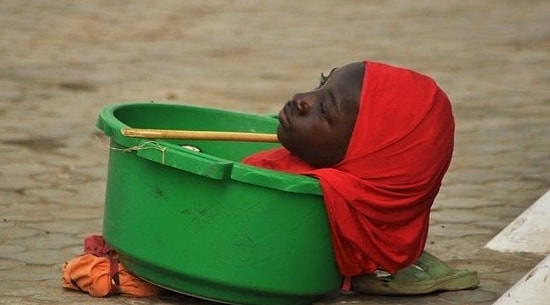 Девушка без рук и ног вынуждена жить в пластиковом тазу