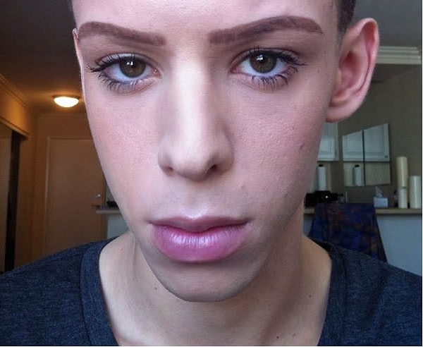 1. Это 22-летний Винни Ох (Vinny Ohh) из Лос-Анджелеса. Впервые он обратился к пластике 5 лет назад, чтобы увеличить губы с помощью филлеров