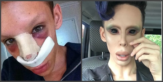 Этот парень потратил $50.000, чтобы превратиться в "бесполого" пришельца!