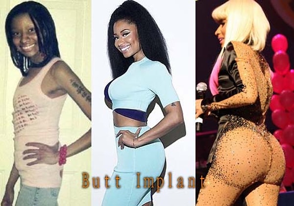 11. Ники Минаж