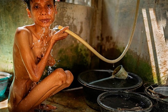 Gördükçe Ruhunuz Sızlayacak: Akıl Hastanesinde Yatmış Hastalara Ait Kişisel Eşyalar