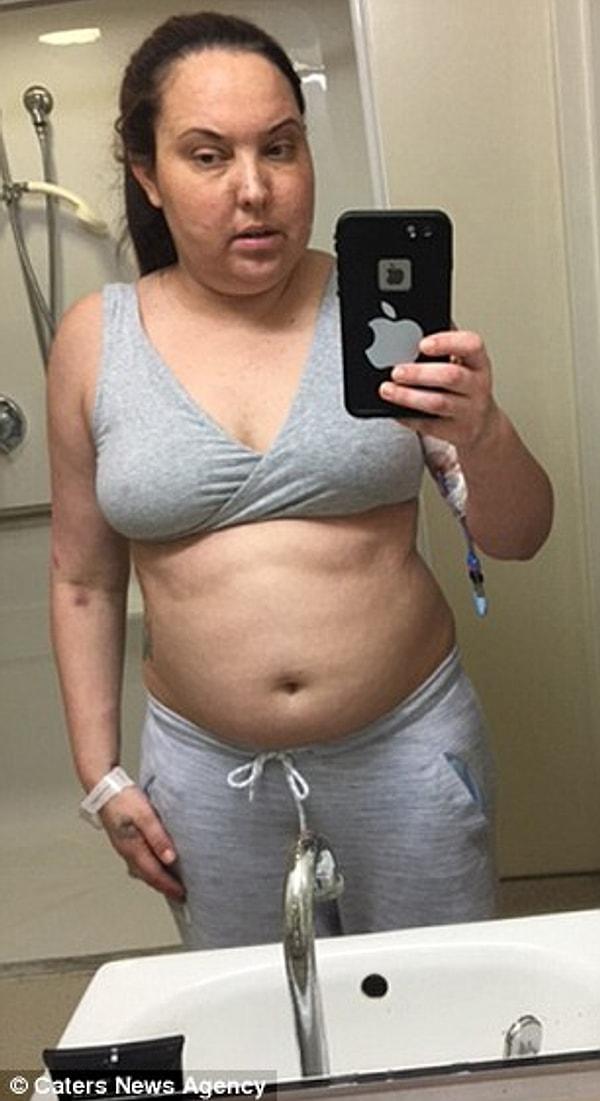 ABD'nin Florida eyaletinde yaşayan Vicki Perez, vücut güzelliği ile öne çıkan hatta bundan para kazanan bir kadındı.
