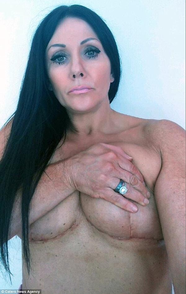 48 yaşında olan Janey, ilk göğüs ameliyatını 2004 yılında olmuştu.