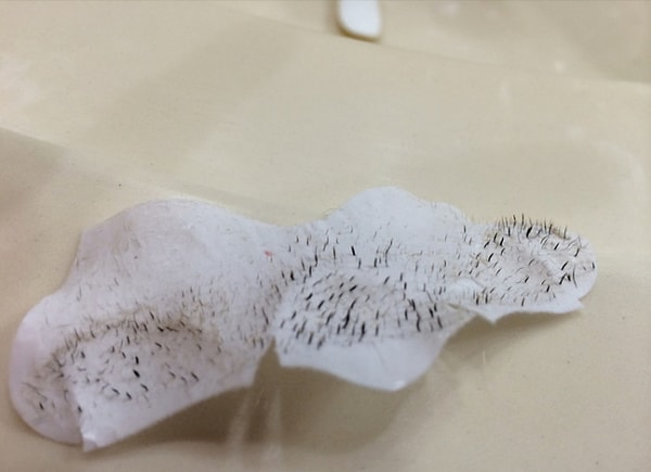 13. И, наконец, любоваться использованными очищающими полосками для носа