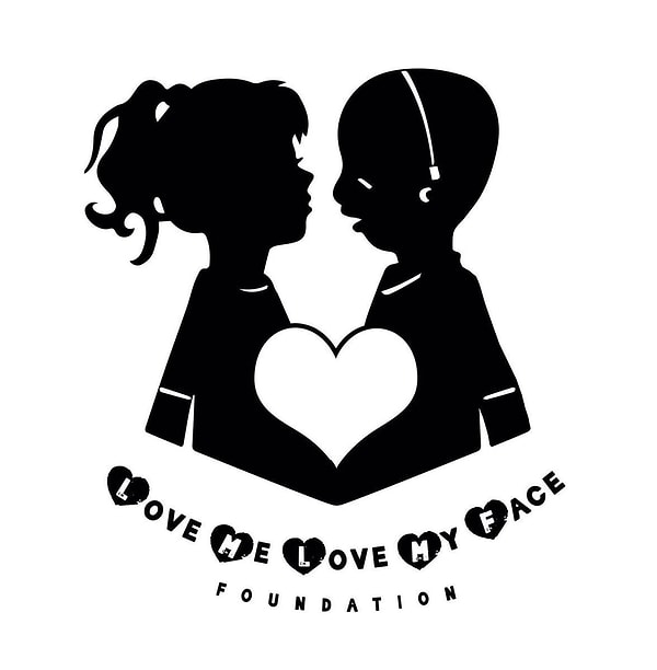 15. Джоно даже создал собственный фонд в поддержку больных синдромом Тричера Коллинза детей