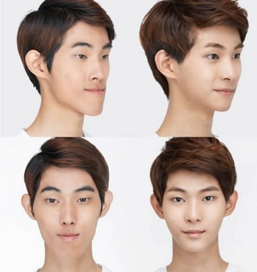 19 Mind Blowing Before And After Faces From South Korea's Plastic