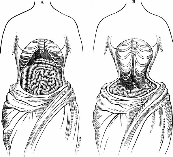 7. В них невозможно было дышать, а внутренние органы деформировались под давлением этого модного предмета одежды