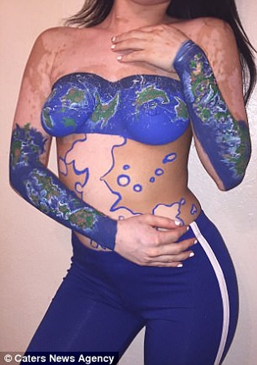 "Siyah bir keçeli kalemle vitiligo lekelerimin etrafından geçene kadar ne kadar güzel olduklarını fark etmemiştim," diyor Ahsley.