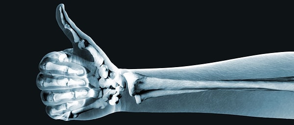 8. Корица укрепляет кости