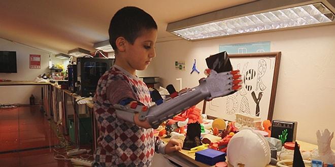 Uzuv Deformasyonu Yaşayan Çocuklara Daha İyi Bir Yaşam Sağlayarak Fark Yaratıyorlar: Robotel