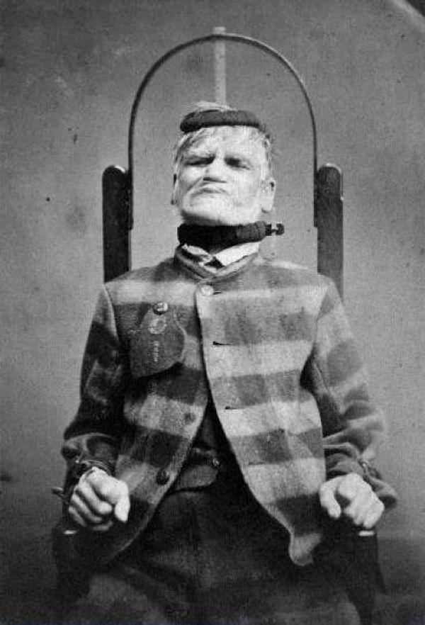 29. A patient in a restraint chair at the West Riding Lunatic Asylum, Wakefield, Yorkshire ca. 1869
