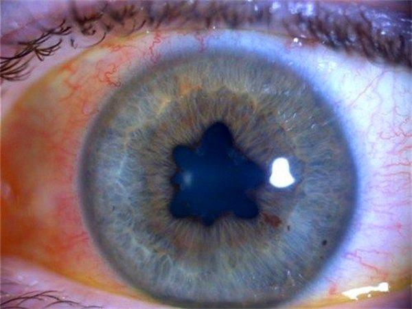 Göz, insan bedeninin beyinden sonra belki de en nadide parçasıdır.