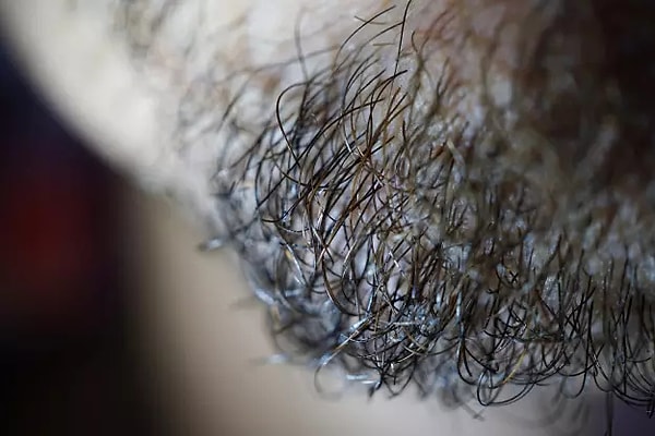 11. Для хаэтофобов этот крупный план — худшее, что может быть на свете.