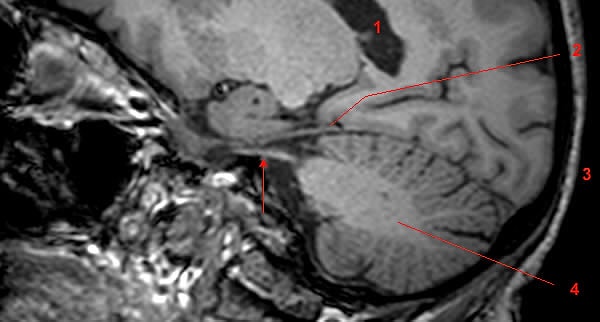 Peki bu iritasyonun sebebi tam olarak nedir?