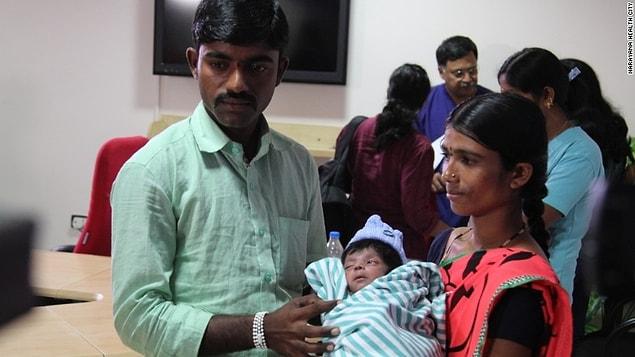 Last month in February, a child in India was born with 4 legs and 2 sexual organs.