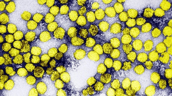 7. Жёлтая лихорадка