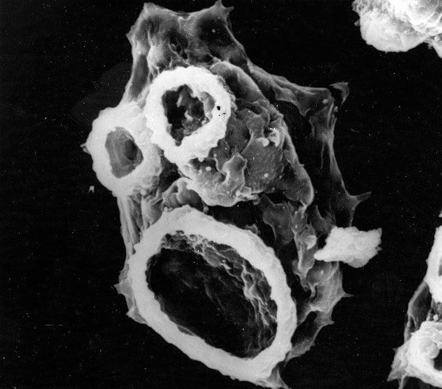 The amoeba takes the shape of a capsule when the human body does not provide optimum living conditions.